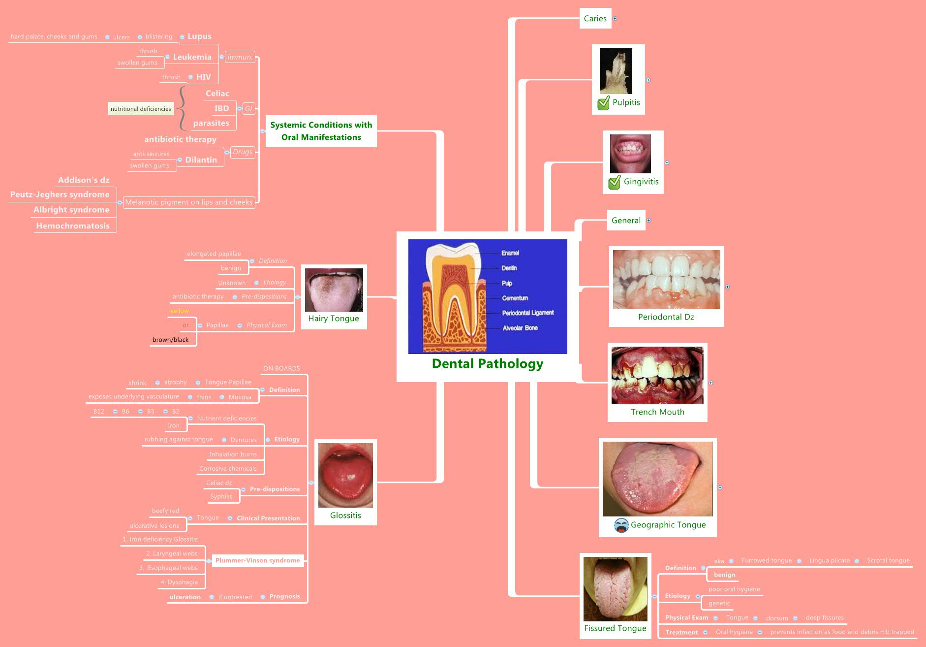 Thumbnail of mind map