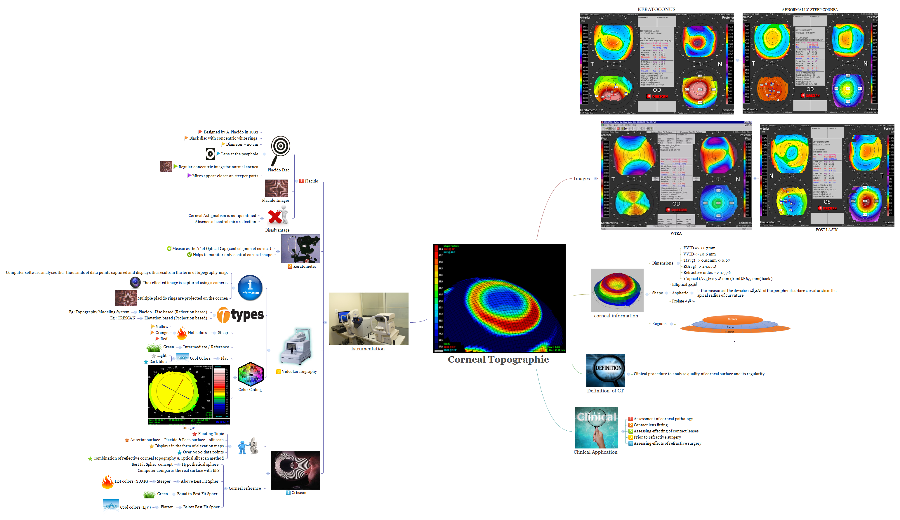 Corneal Topographic | 1010111770li - Xmind